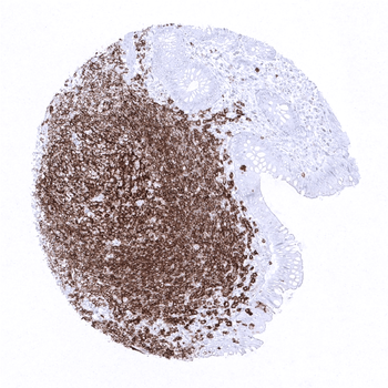 CD20 antibody