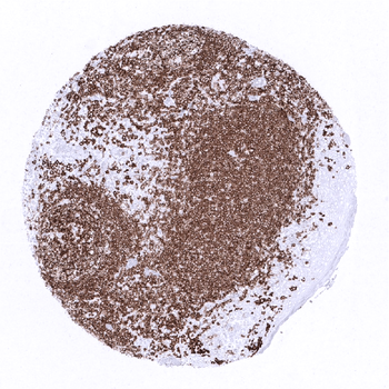 CD20 antibody