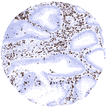 CD7 antibody