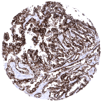 CD7 antibody