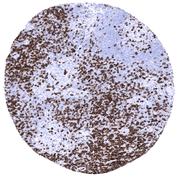 CD7 antibody