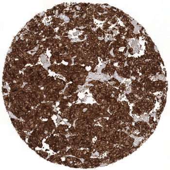 NSE gamma antibody (MSVA-451M)