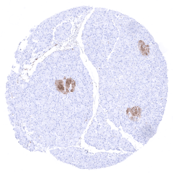 NSE gamma antibody (MSVA-451M)