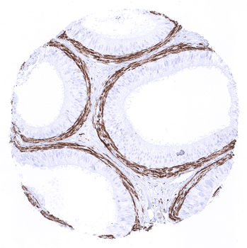 Calponin 1 antibody (MSVA-455R)
