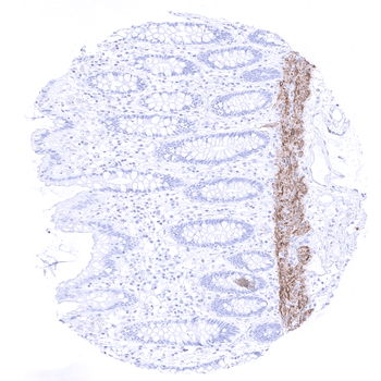 Calponin 1 antibody (MSVA-455R)