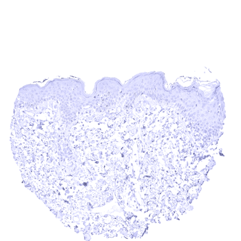 Cytokeratin 13 antibody