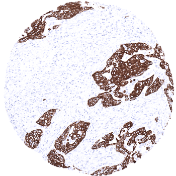 Cytokeratin 13 antibody