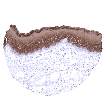 Cytokeratin 13 antibody
