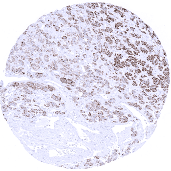 Melan A CR (Cross Reactive) antibody (MSVA-901M+)