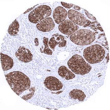 Melan A CR (Cross Reactive) antibody (MSVA-901M+)