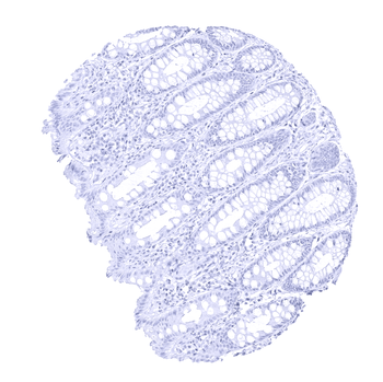 PMEL / gp100 / Melanosome antibody