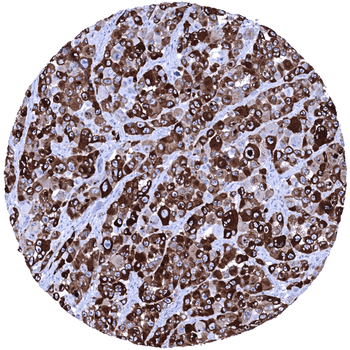 PMEL / gp100 / Melanosome antibody