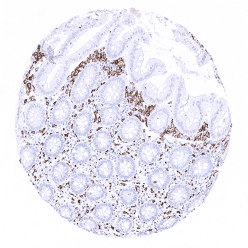 CD163 antibody