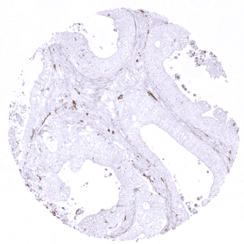 CD163 antibody