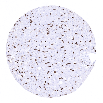 CD163 antibody