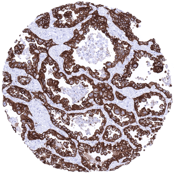 EpCAM antibody (MSVA-326R)