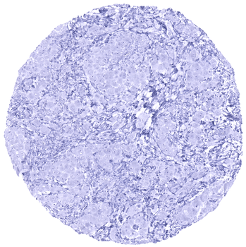 EpCAM antibody