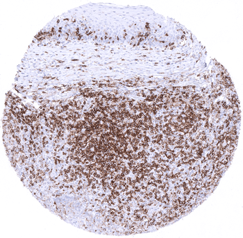 CD4 antibody
