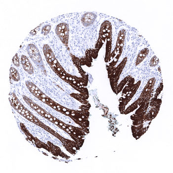 Cytokeratin 19 antibody