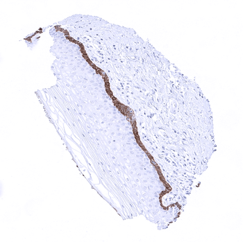 Cytokeratin 19 antibody