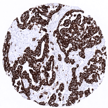 Cytokeratin 19 antibody
