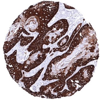 Cytokeratin 14 antibody
