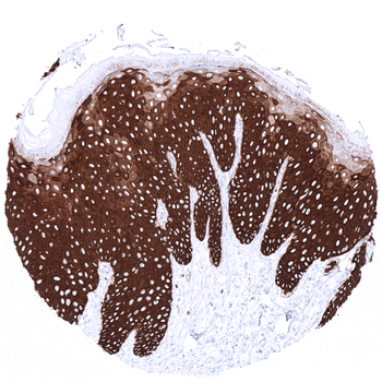 Cytokeratin 14 antibody