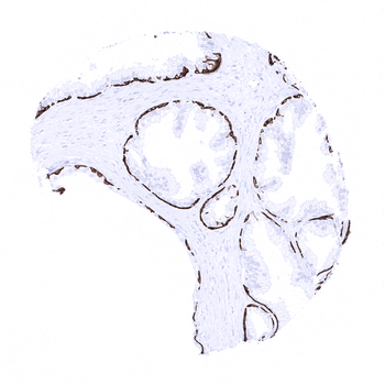 Cytokeratin 14 antibody