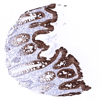 Cytokeratin 20 antibody