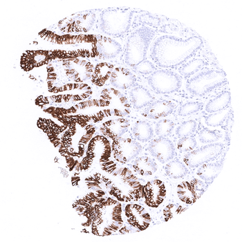 Cytokeratin 20 antibody