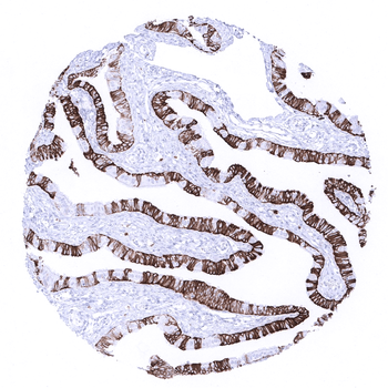 Cytokeratin 7 antibody