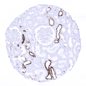 Cytokeratin 7 antibody