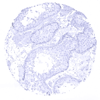 Cytokeratin 7 antibody