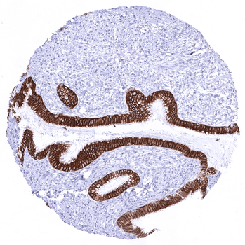 Cytokeratin 18 antibody