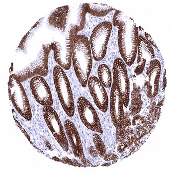 Cytokeratin 18 antibody