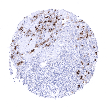 Mesothelin antibody