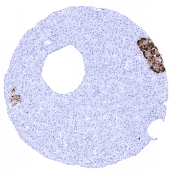 Chromogranin A antibody