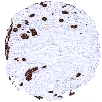 Chromogranin A antibody