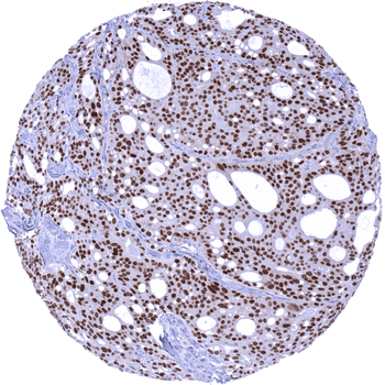 Androgen Receptor antibody