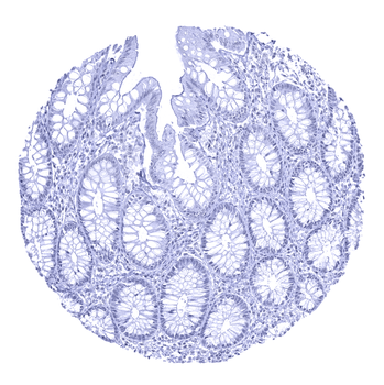 Androgen Receptor antibody
