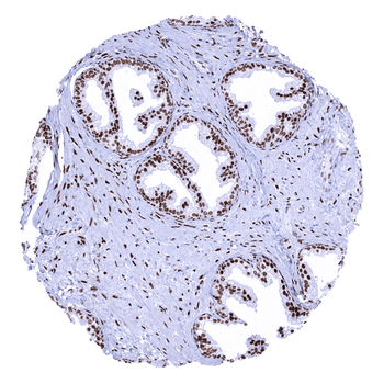 Androgen Receptor antibody