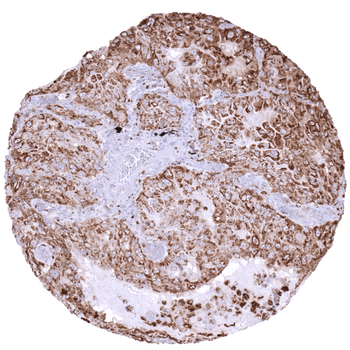 Napsin A antibody