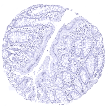 Thyroglobulin antibody
