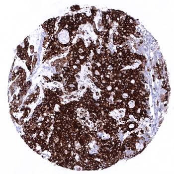 MUC5AC antibody