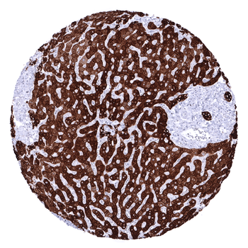 Cytokeratin, Pan antibody (MSVA-000R)