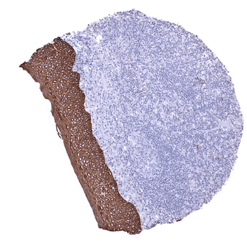 Cytokeratin, Pan antibody (MSVA-000R)