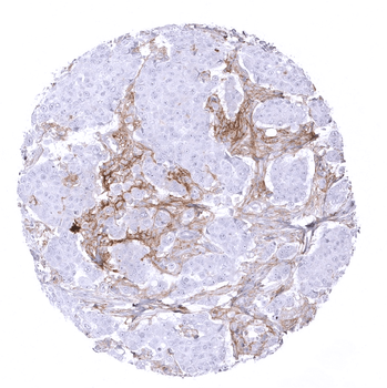 PD-L1 antibody