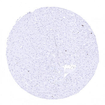 Ki-67 antibody (MSVA-267M)