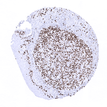 Ki-67 antibody (MSVA-267M)