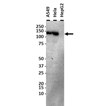 SMC1A Polyclonal Antibody